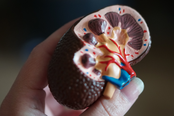 Kidney model in hand of observer