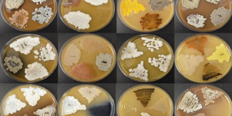 microbial strains in petri dishes 