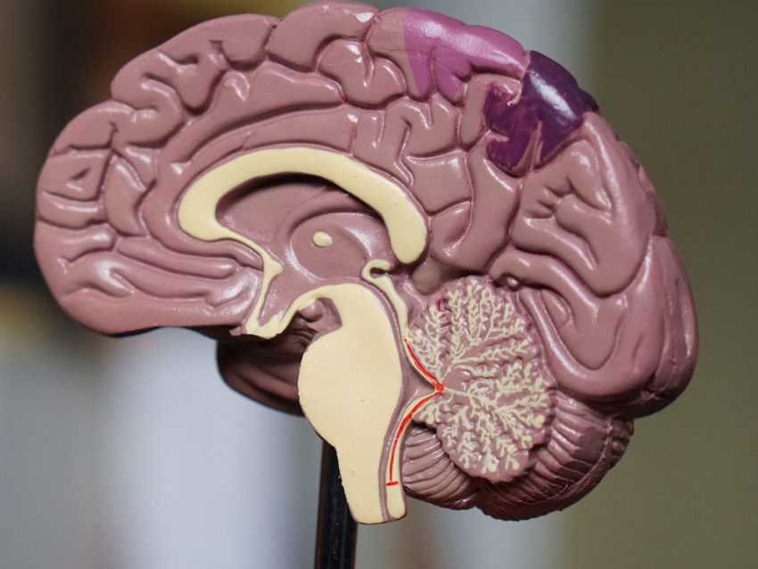 Brain model