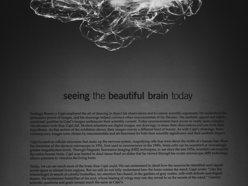 brain image