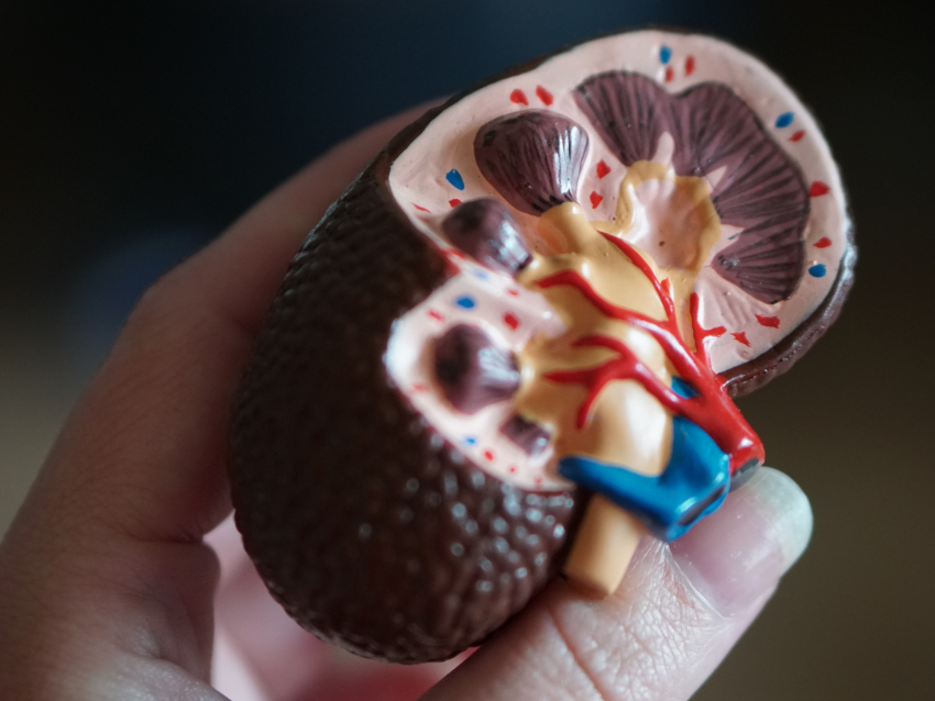 Kidney model in hand of observer