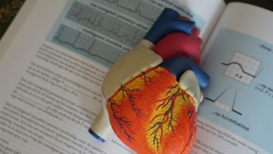 plastic heart model to explain how the heart works to patients