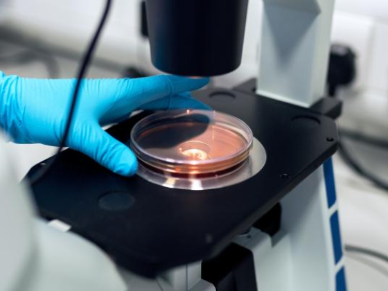 Gloved hands holding a petri dish with red liquid under a microscope
